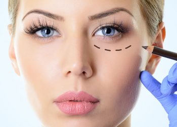 Blefaroplastia-Cirurgia-Plástica-das-Pálpebras