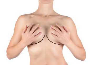 Female breasts marked for plastic operation, isolated on white. Woman cover her bust by her hands. Well groomed skin. Health, mammoplasty, breast lift and cosmetic surgery concept