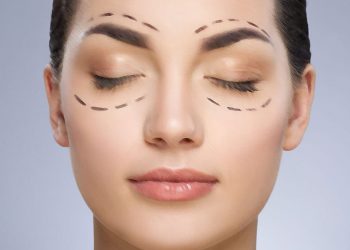 blefaroplastia