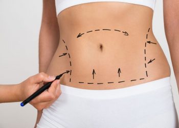 clinica-britannia-abdominoplasty